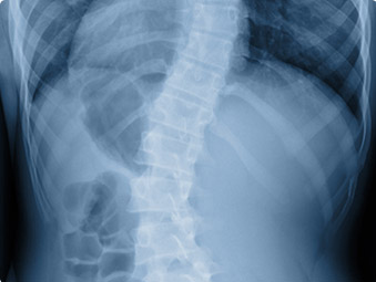 Spine Disorders And Surgery Center